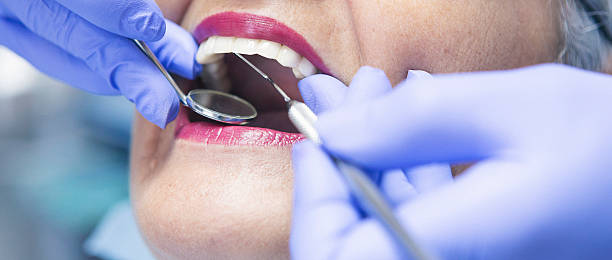 Best Emergency Dental Care for Broken or Chipped Teeth in Great Neck Estates, NY